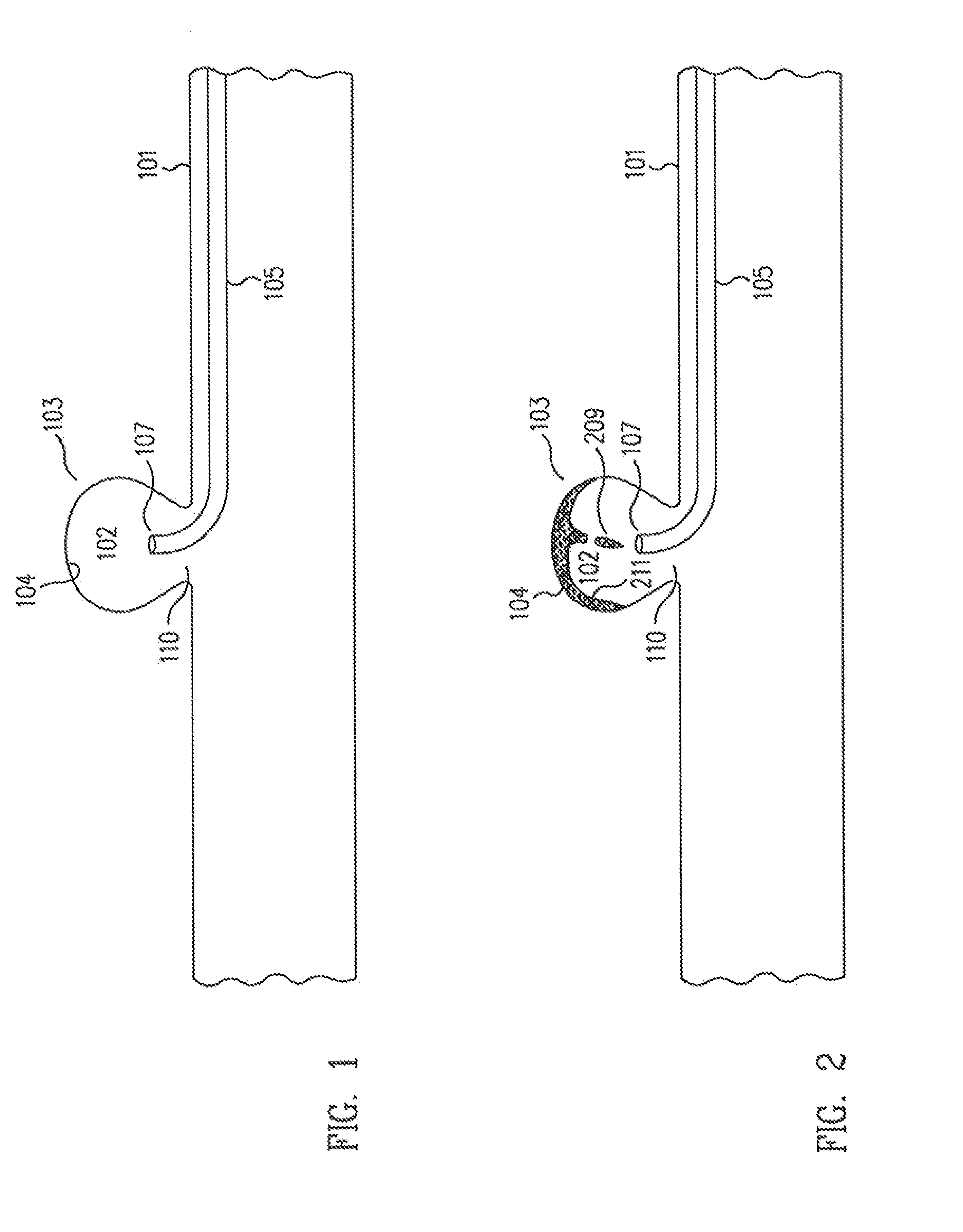 Method and apparatus for aneurismal treatment