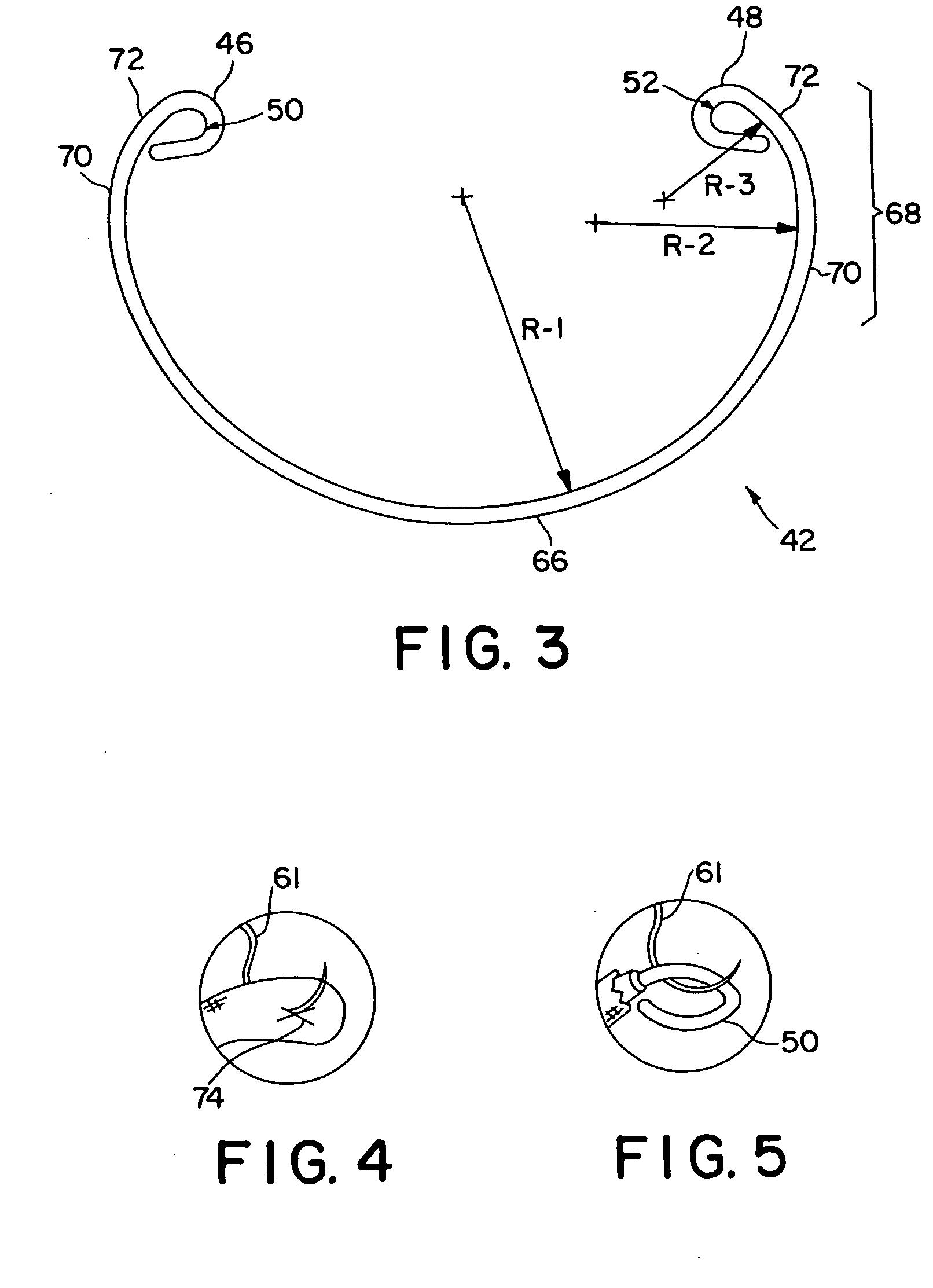 Annuloplasty band and method