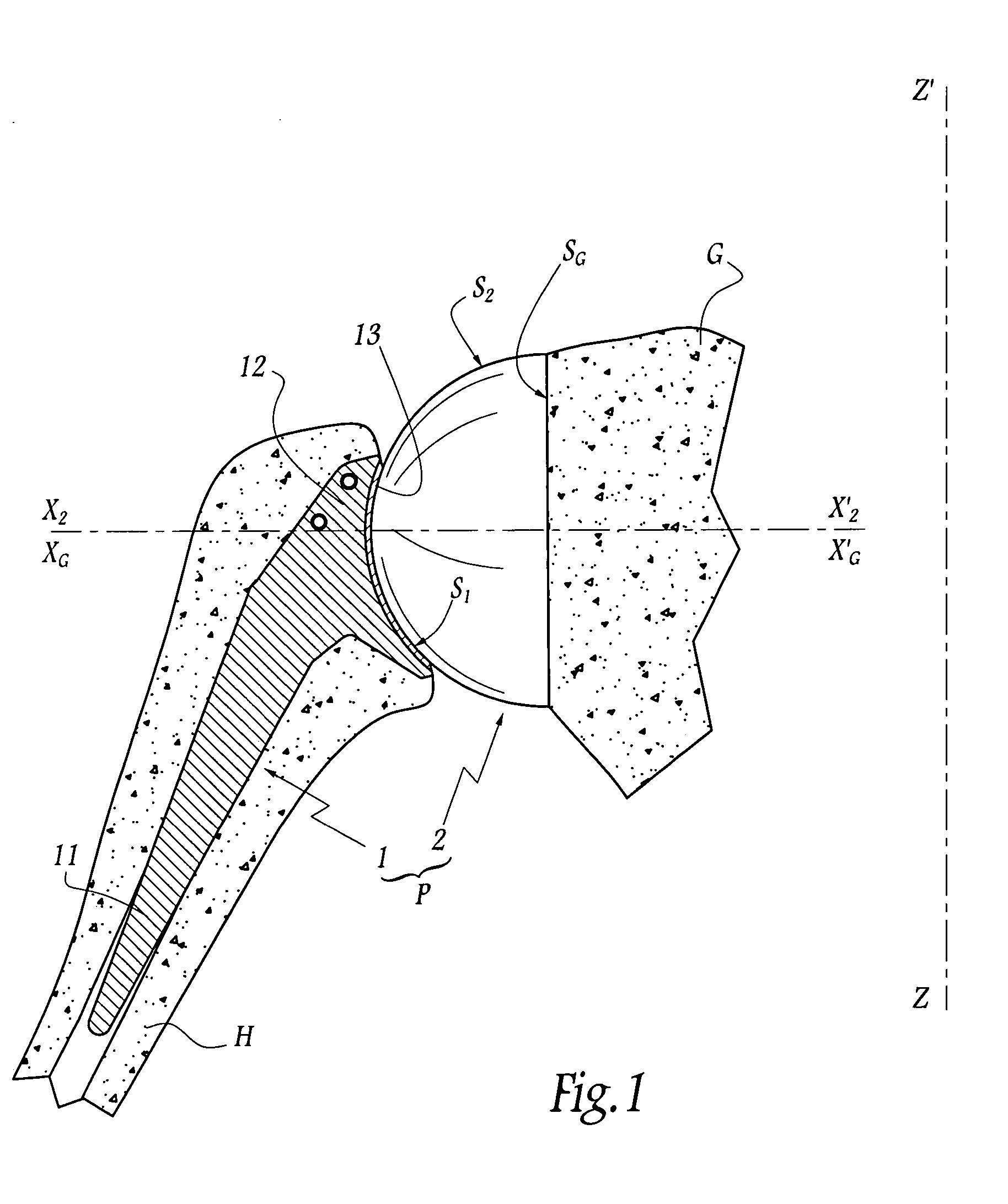 Glenoidal component, set of such components and shoulder prosthesis incorporating such a glenoidal component