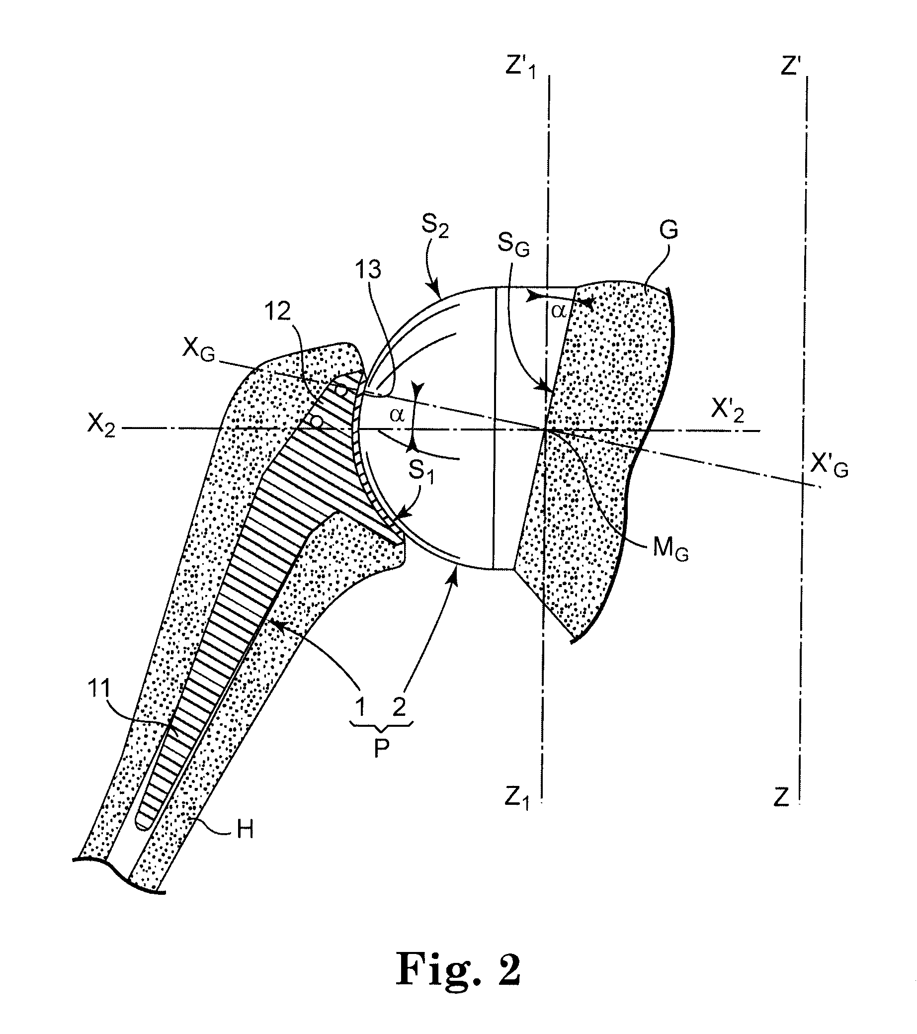 Glenoidal component, set of such components and shoulder prosthesis incorporating such a glenoidal component