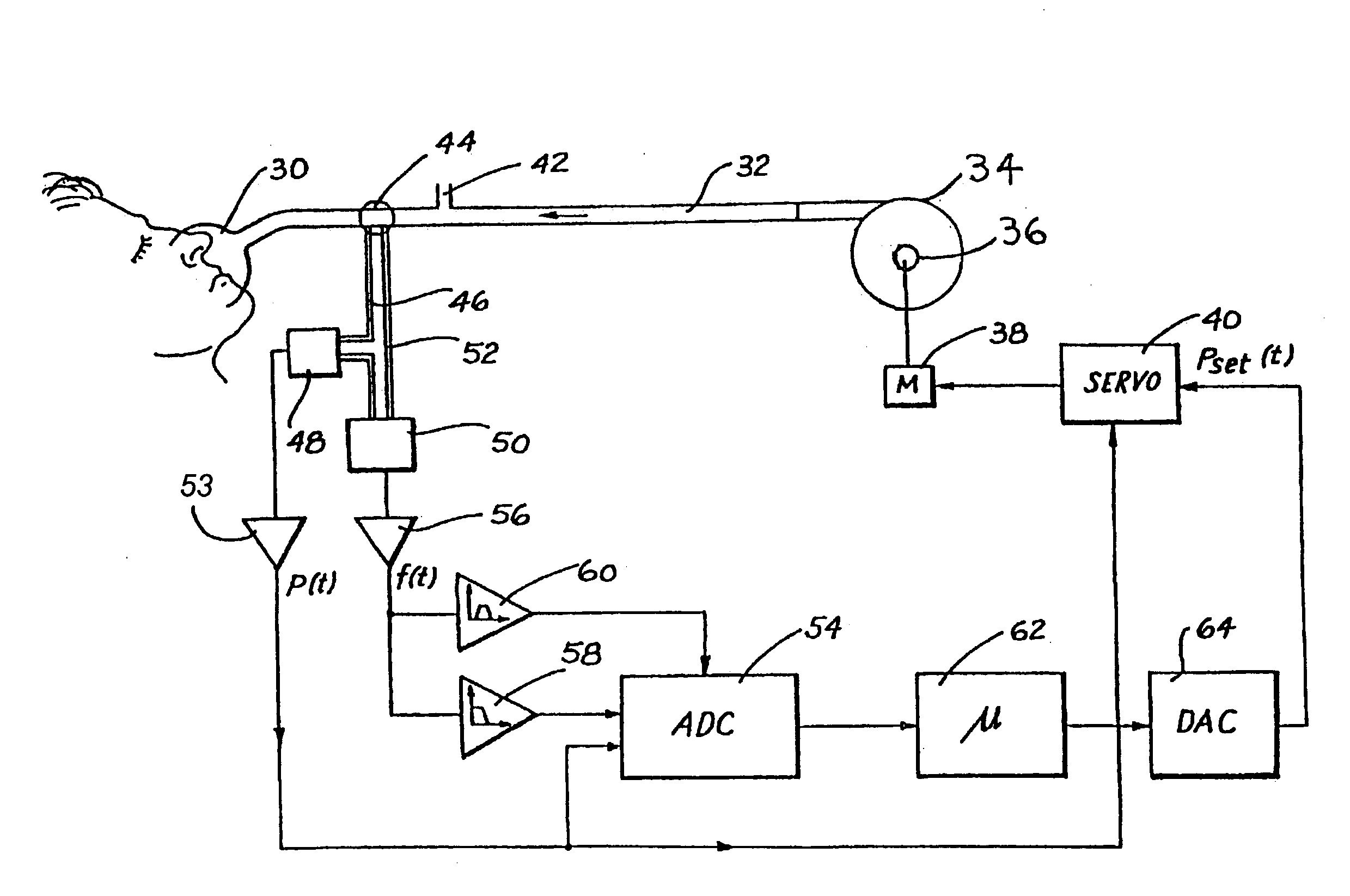 Administration of CPAP treatment pressure in presence of apnea