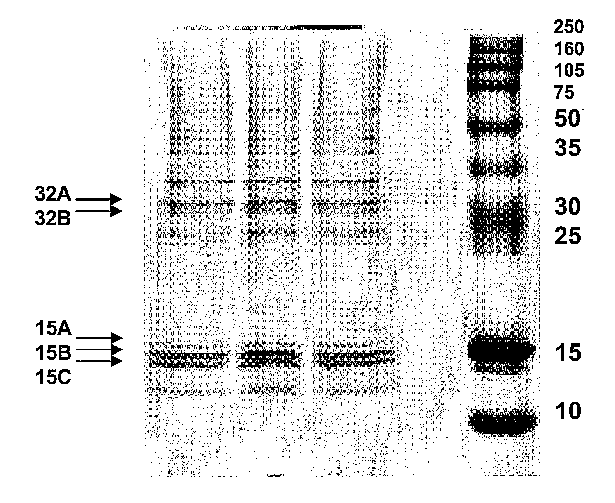 Sigma-2 Receptor, Method of Screening of Specific Ligands and Use of the Same in Diagnostic or Therapeutic Methods