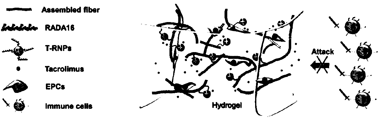 Hydrogel system for anchoring nano drug carrier and use thereof in preparing drug delivery system