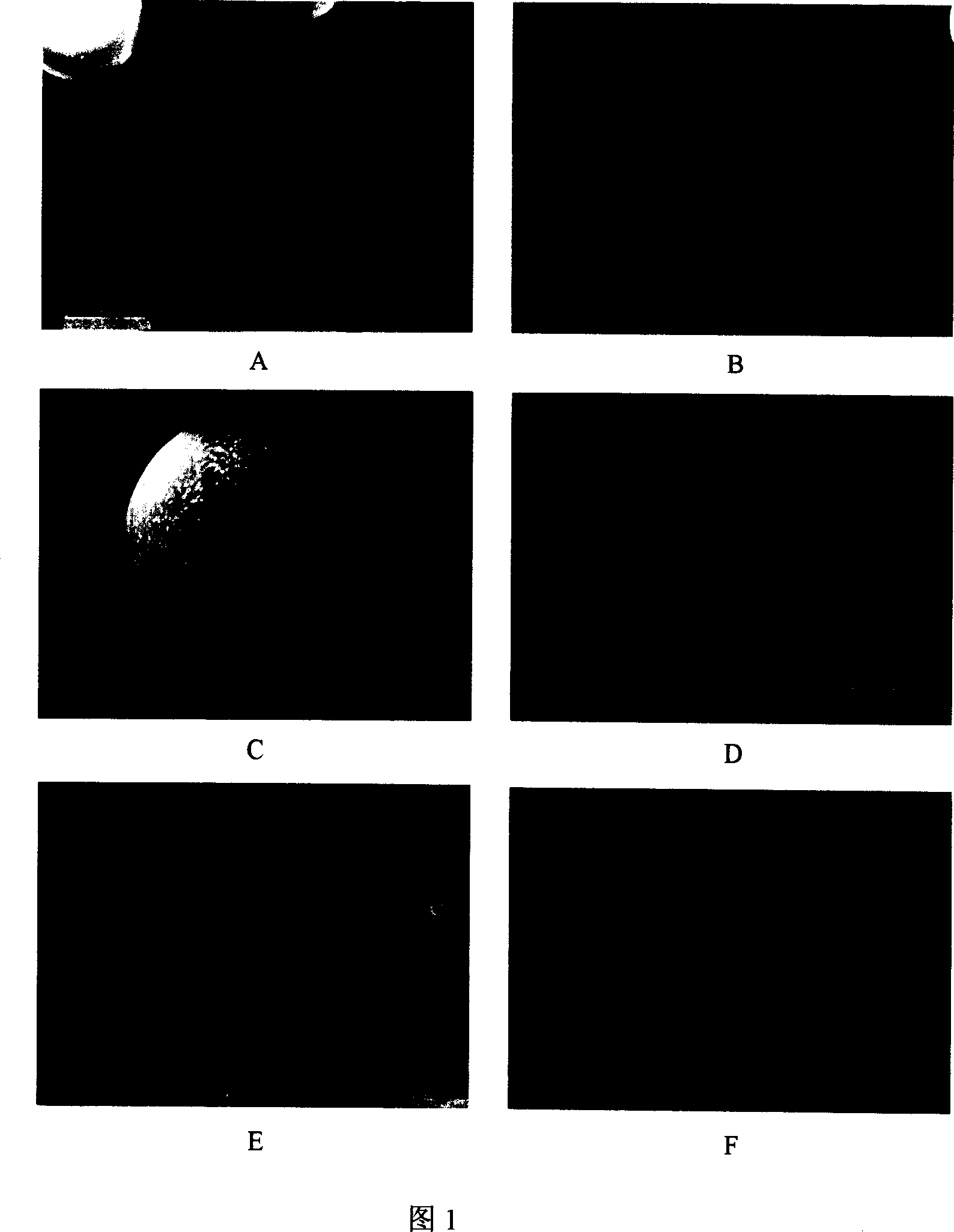 Composite microsphere prepn of lactic acid-hydroxyacetic acid copolymer and its prepn process