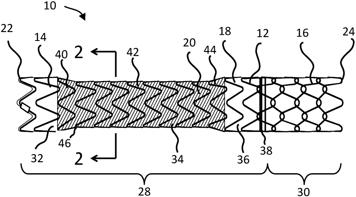 Diametrically adjustable endoprostheses and associated systems and methods