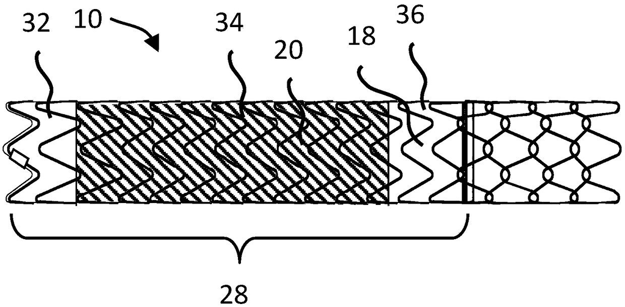 Diametrically adjustable endoprostheses and associated systems and methods