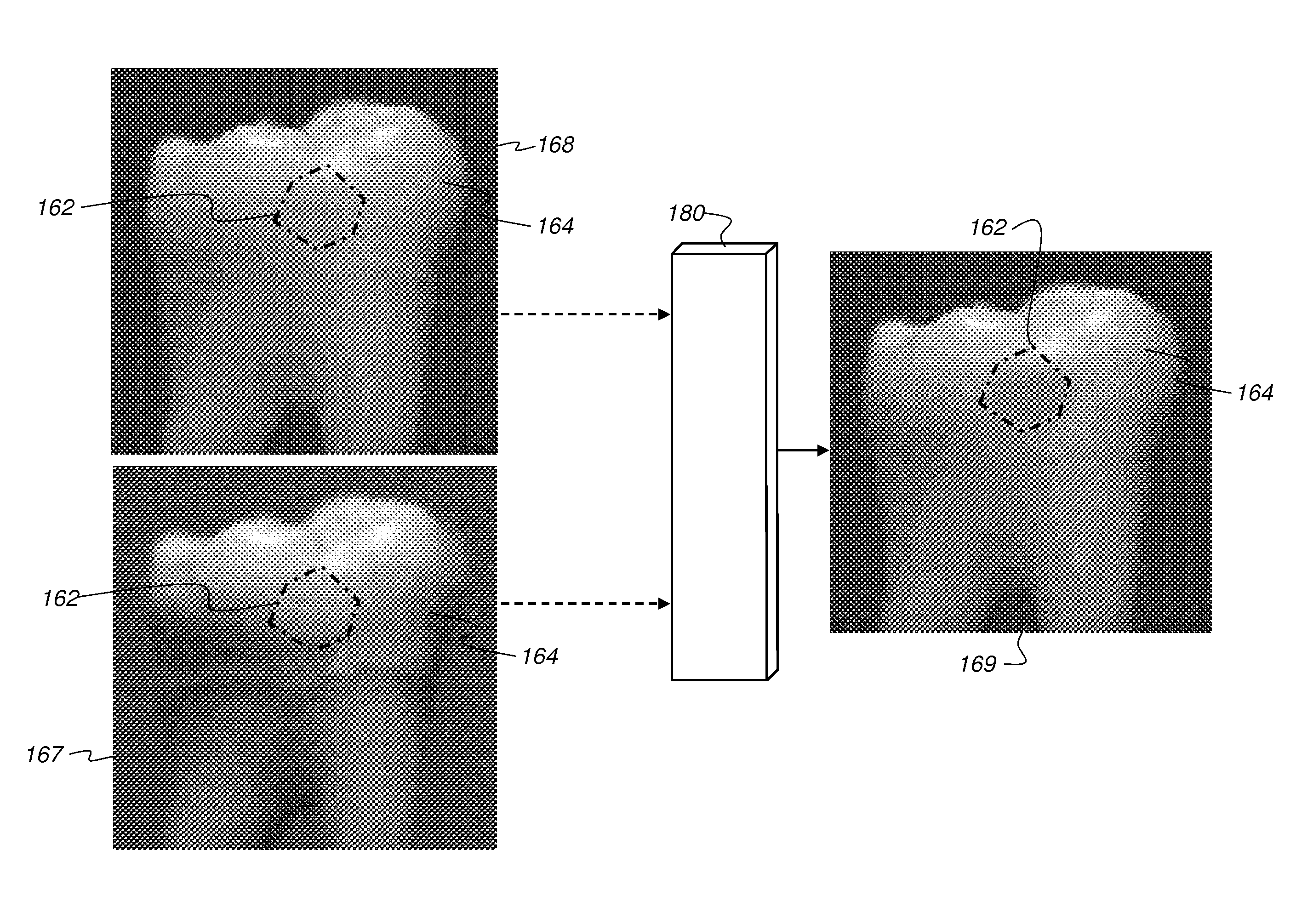 Method for quantifying caries