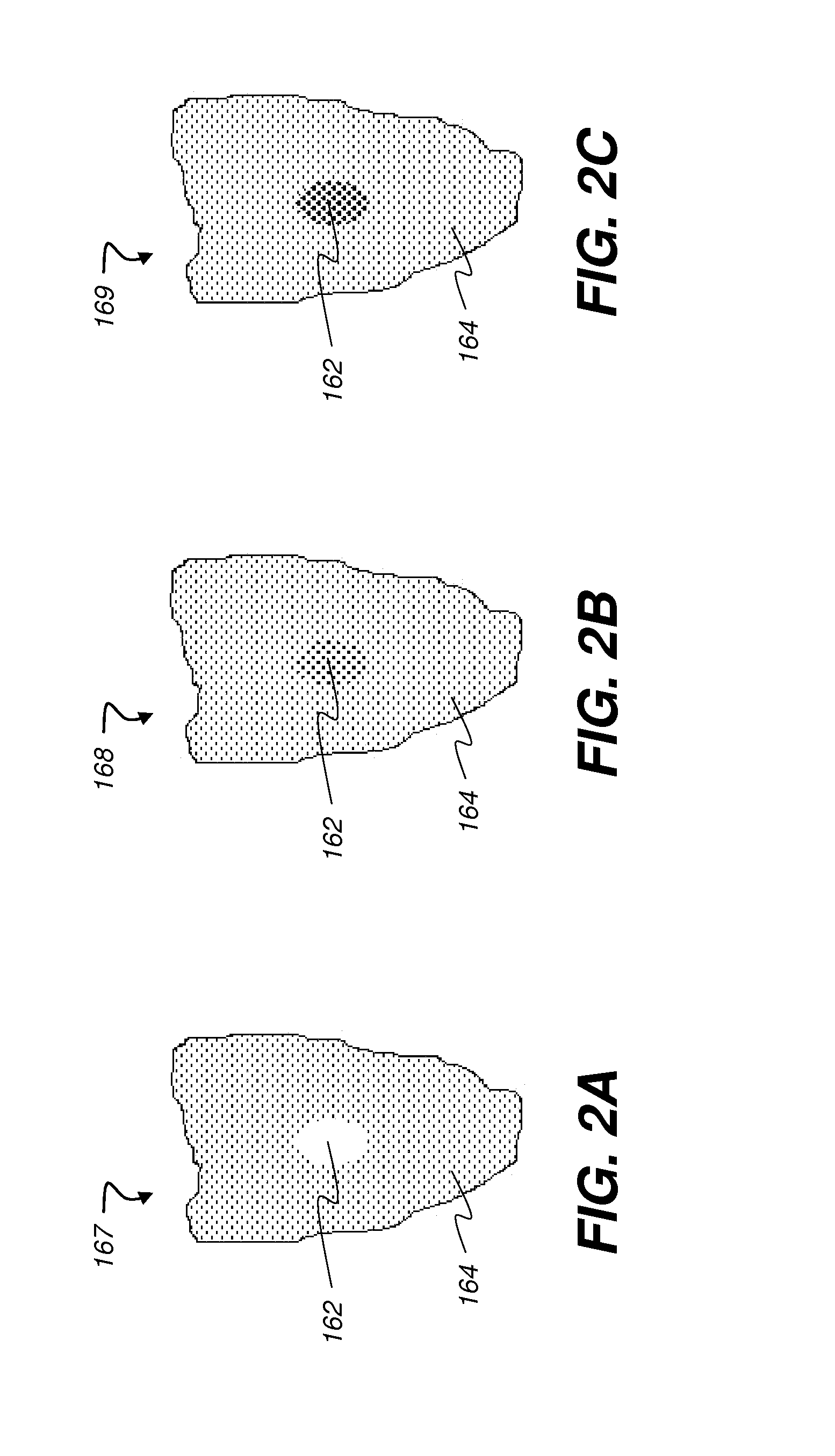 Method for quantifying caries