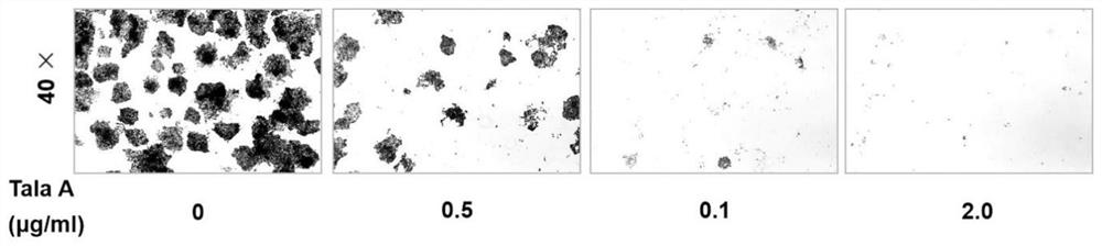 Application of Talaroconvolutin A in anticancer drugs and foods