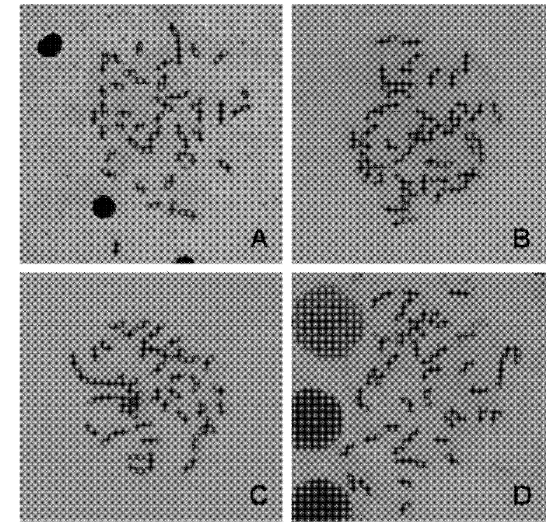 Chromosome specimen preparation liquid for laser microdissection and application thereof