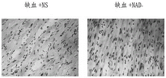 Application of nicotinamide adenine dinucleotide in preparation of drug for preventing and treating heart ischemic injuries