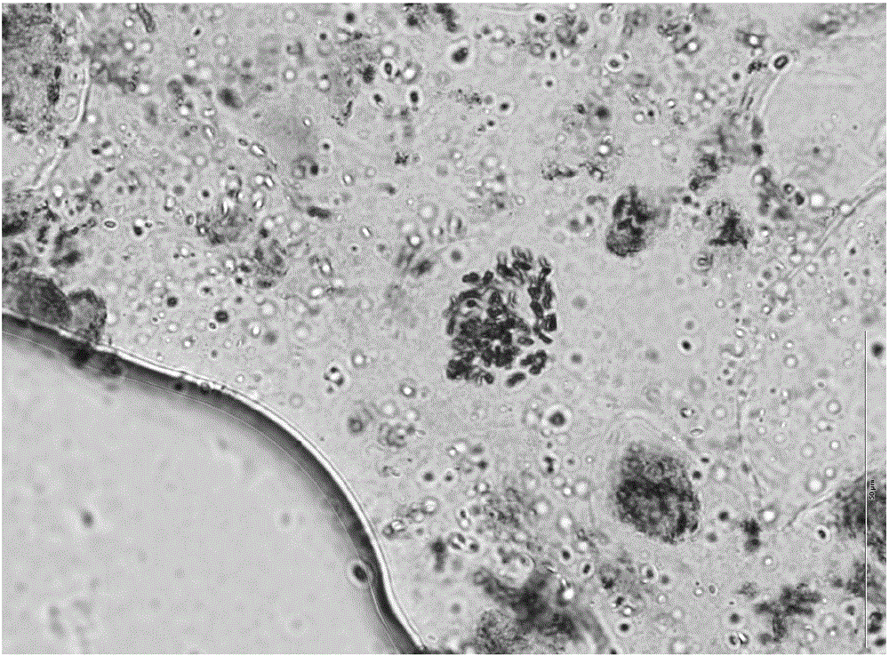 Method for induction of lycium ruthenicum murr tetraploid through tissue culture