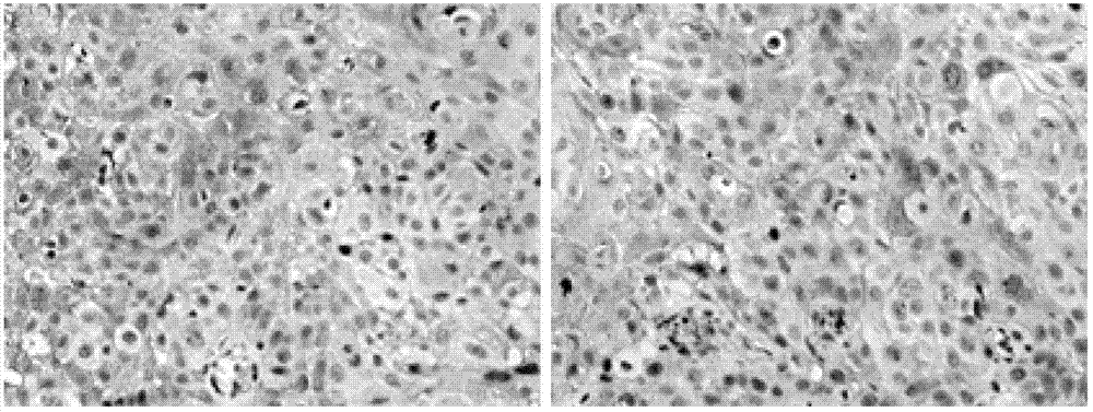 Application of esophageal squamous cell carcinoma primary tumor strain CH-H-1