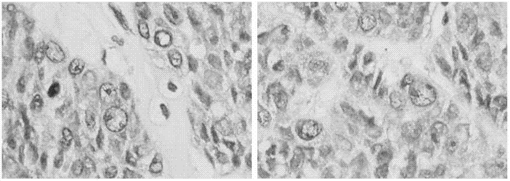 Application of esophageal squamous cell carcinoma primary tumor strain CH-H-1