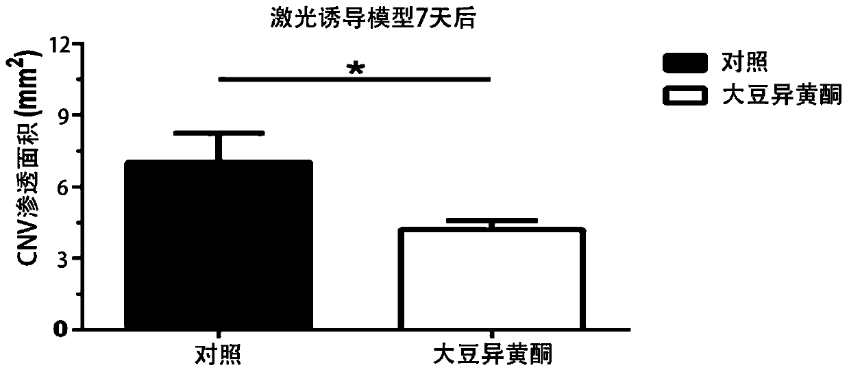 Application of isoflavone in preparation of drug for treating fundus maculopathy