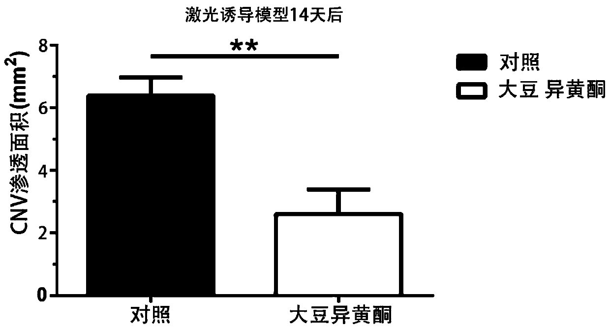 Application of isoflavone in preparation of drug for treating fundus maculopathy