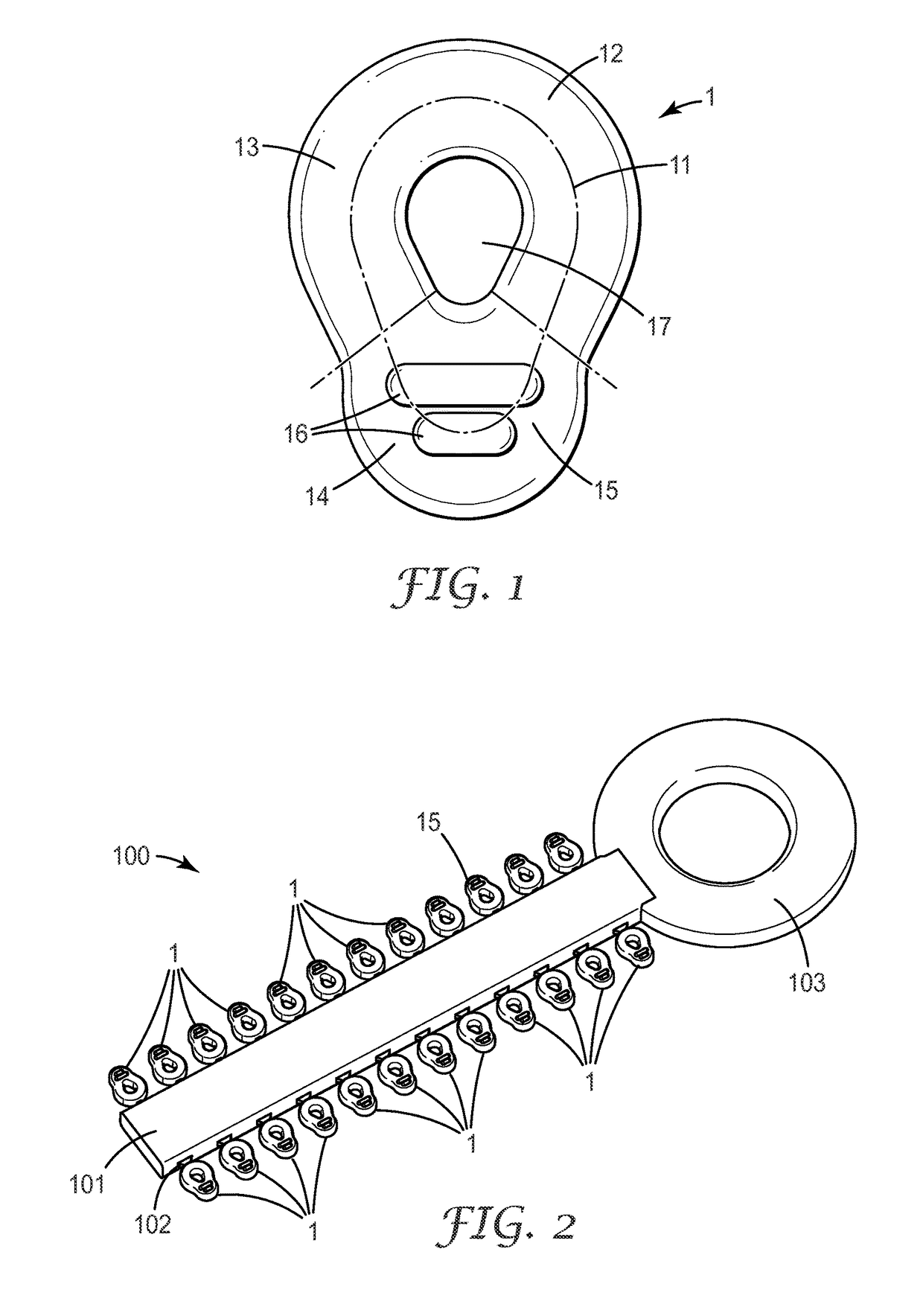 An orthodontic ligature