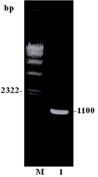 Entamoeba histolytica galactose/acetylgalactosamine (Gal/GalNAc) polypeptide fragment, and preparing method and application of polypeptide fragment