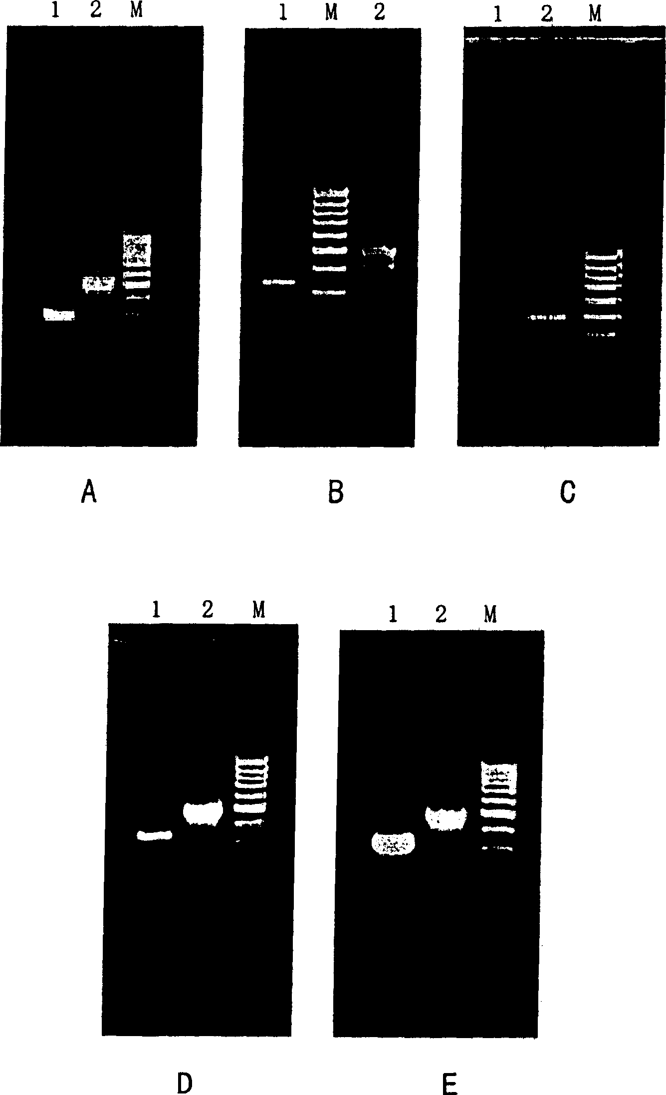 Fluorogenic quantitative PCR method for detecting interleukin 4 gene expression in peripheral-blood under physiological state