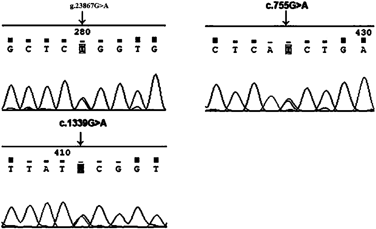 PTGIS gene mutation related to pulmonary hypertension and application thereof