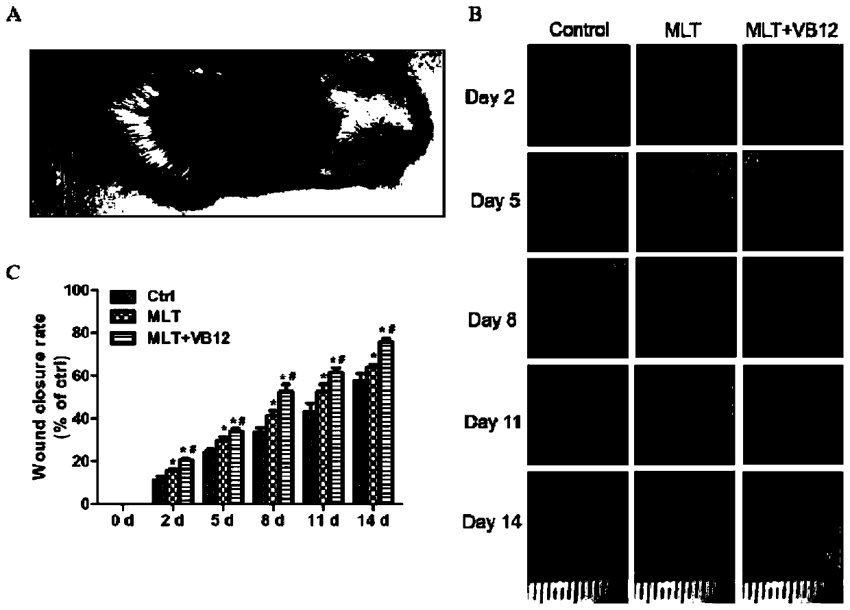 Application of melatonin and mecobalamin in treatment of diabetic wound healing disorders