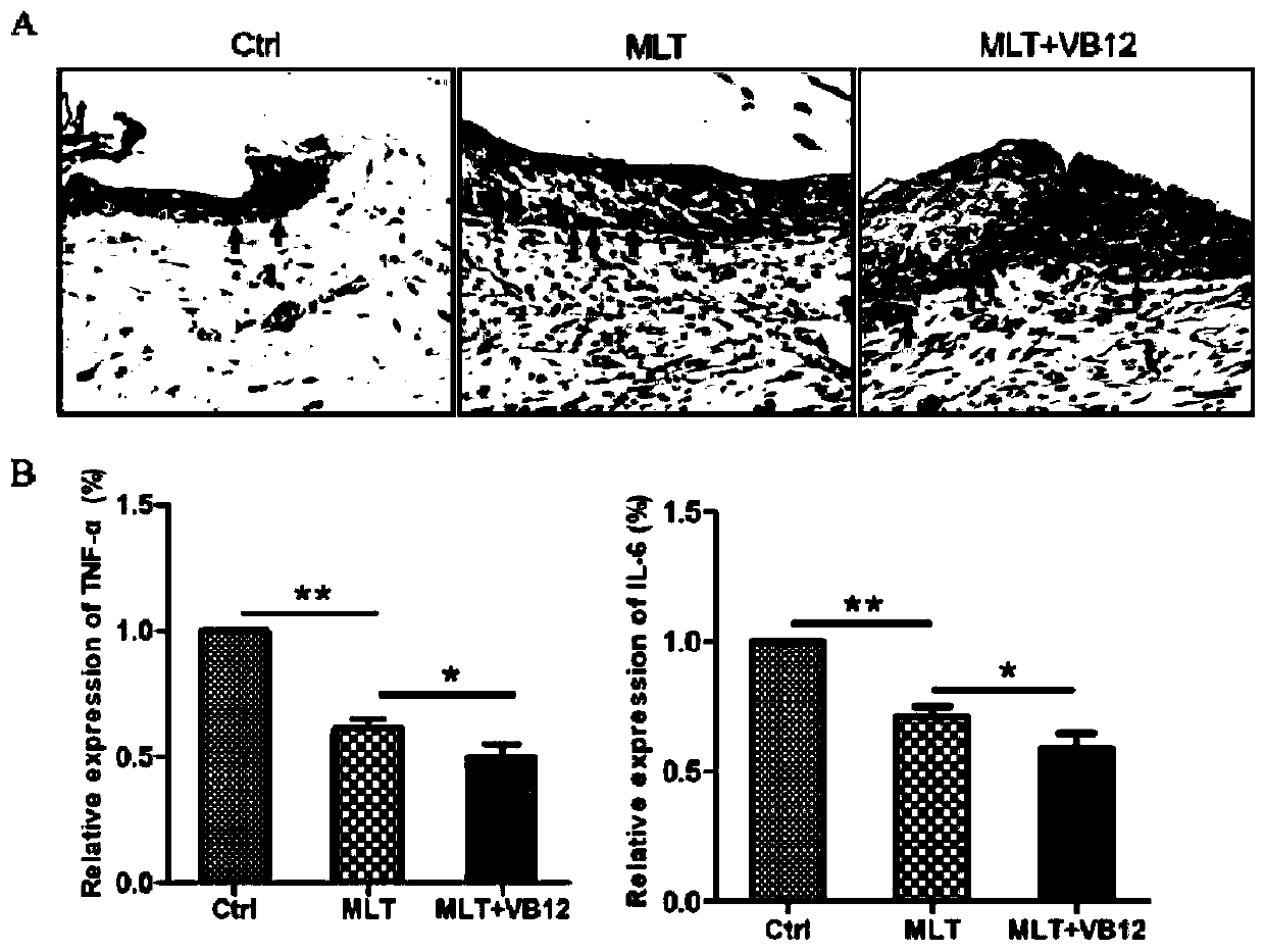 Application of melatonin and mecobalamin in treatment of diabetic wound healing disorders