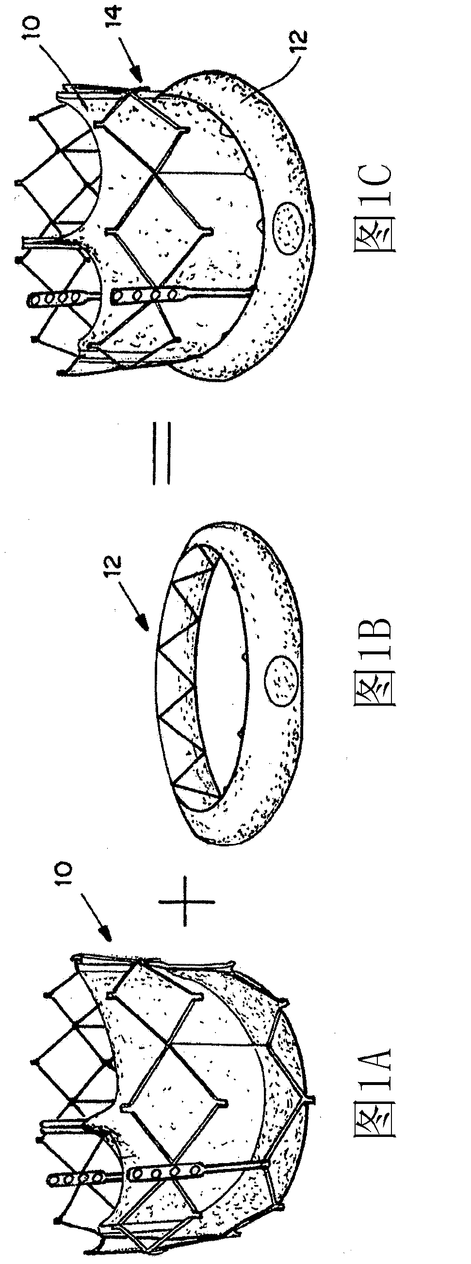 Means for controlled sealing of endovascular devices