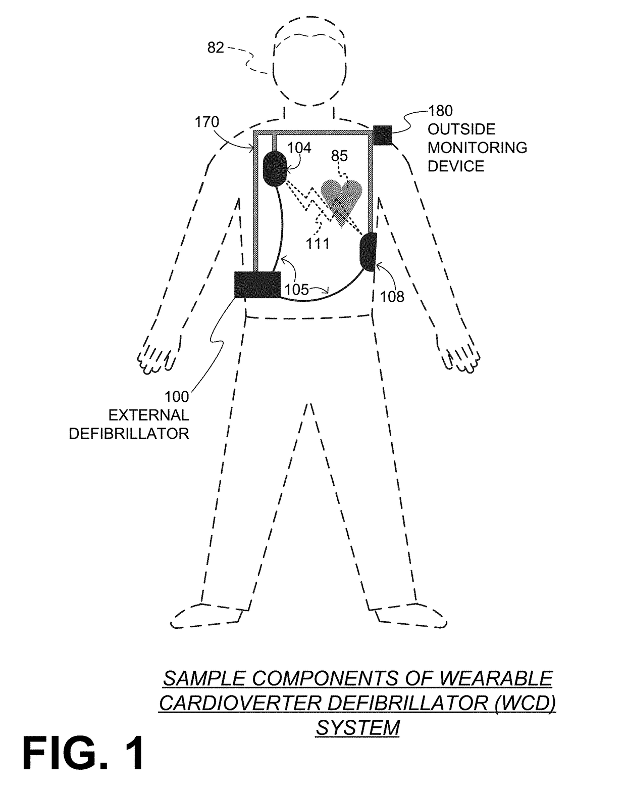 Wearable cardioverter defibrillator (WCD) system computing patient heart rate by multiplying ECG signals from different channels