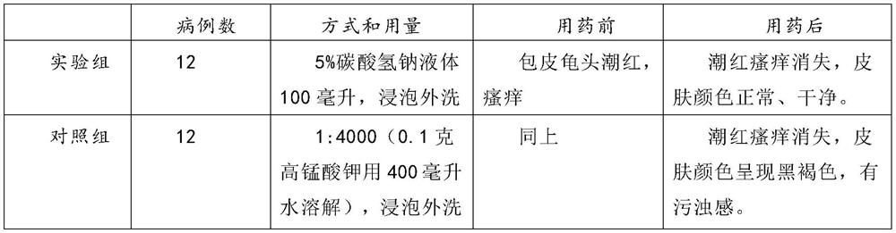 Application of composition lotion in preparation of medicine for treating male balanitis