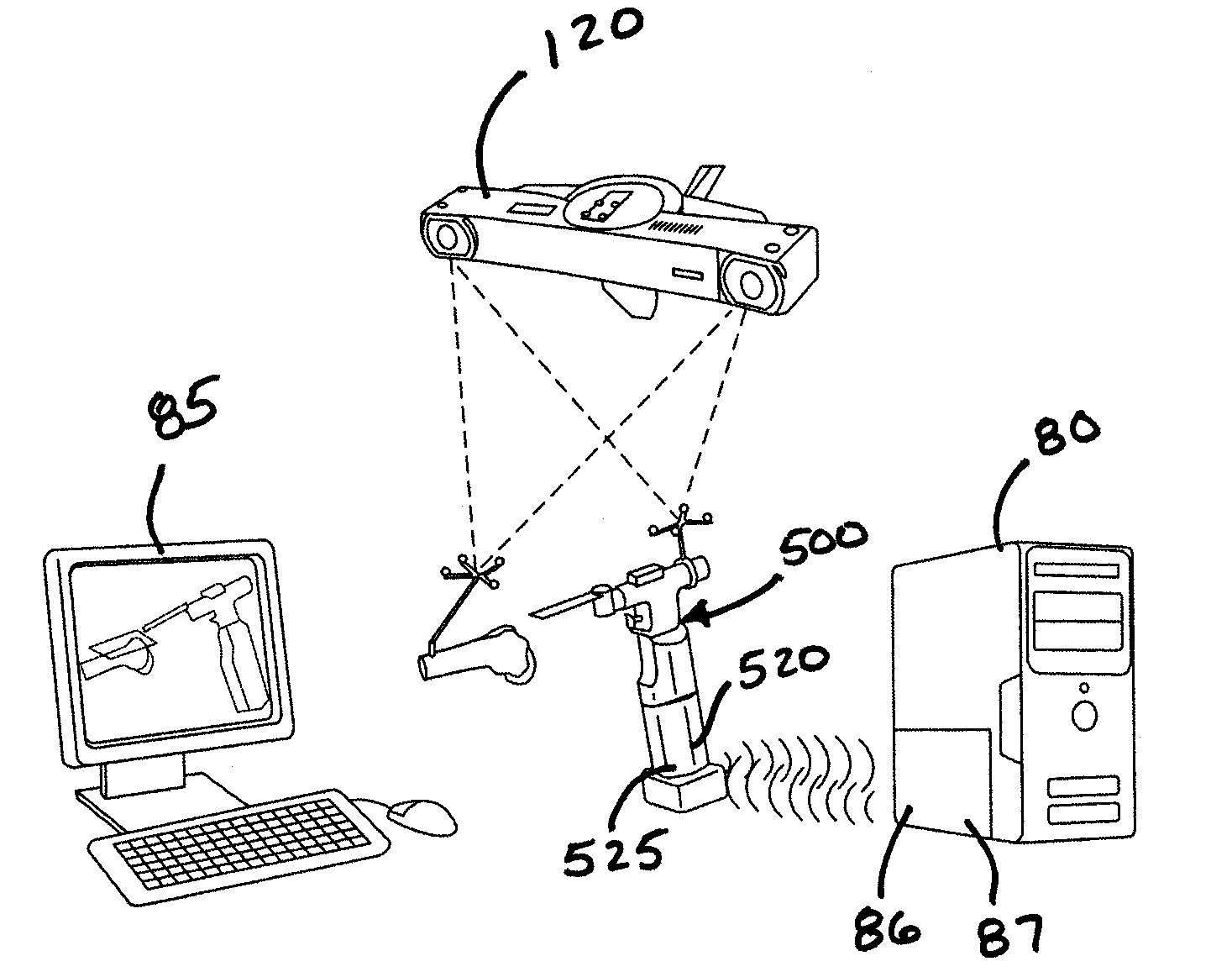 Method and Apparatus for Computer Aided Surgery