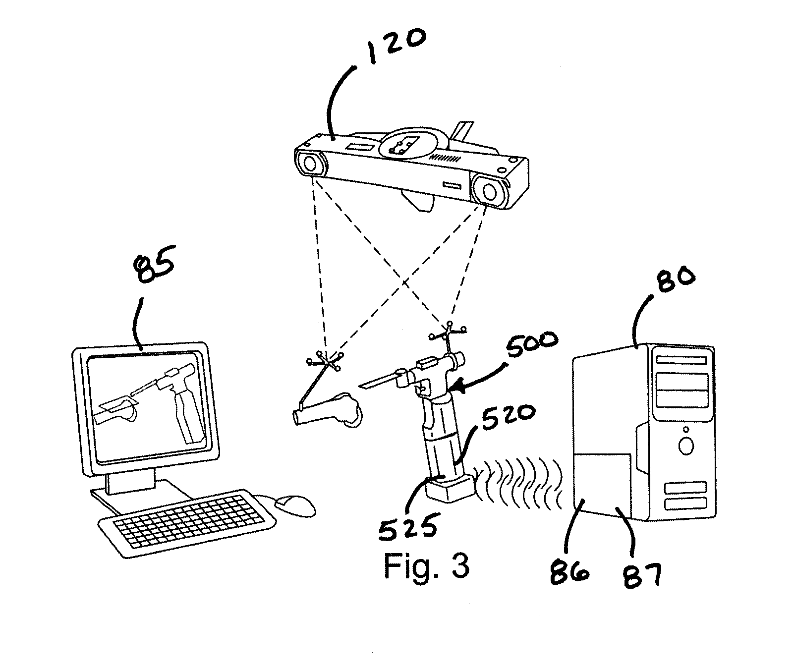 Method and Apparatus for Computer Aided Surgery