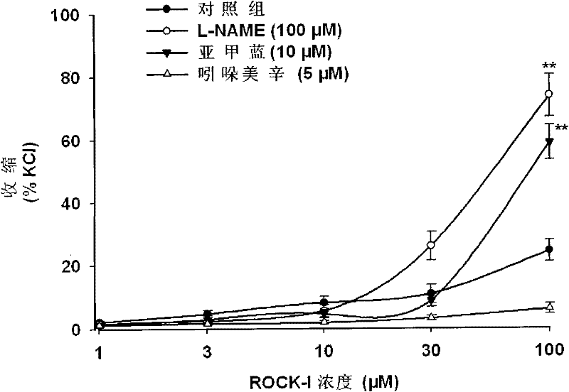 Application of recombinant human Rho kinase to preparation of medicaments