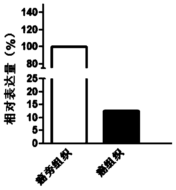 PODN as molecule marker for diagnosis of thyroid cancer