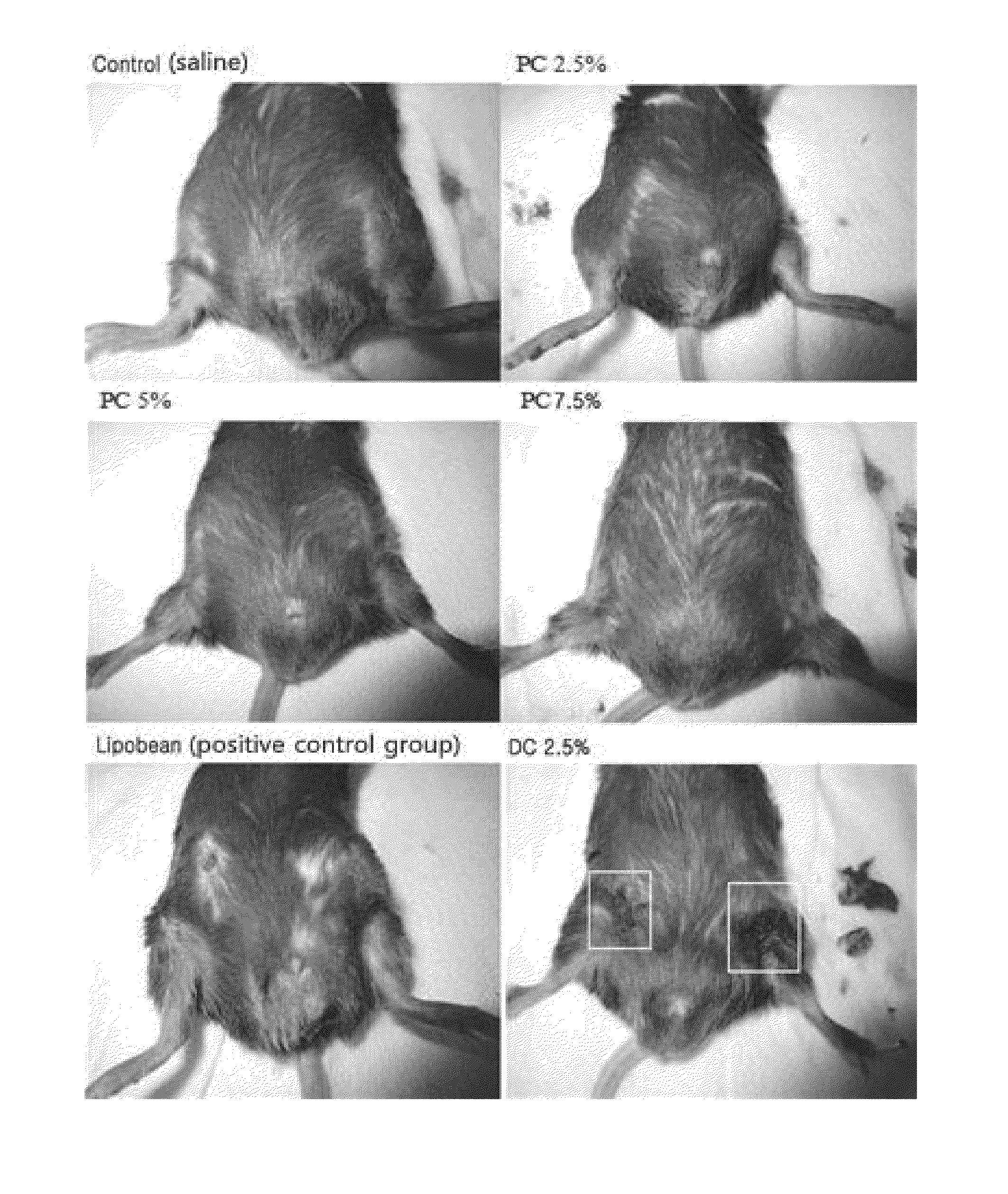 Composition for lipolysis, containing phosphatidylcholine, and preparation method therefor