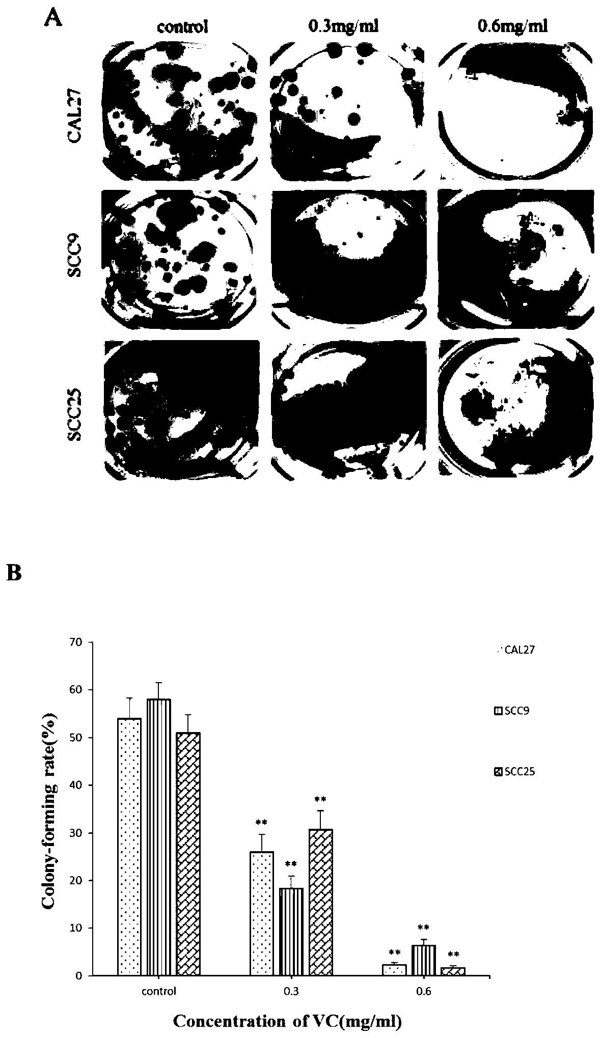 Application of vitamin C in preparation of products for inhibiting human oral squamous cell carcinoma (OSCC)