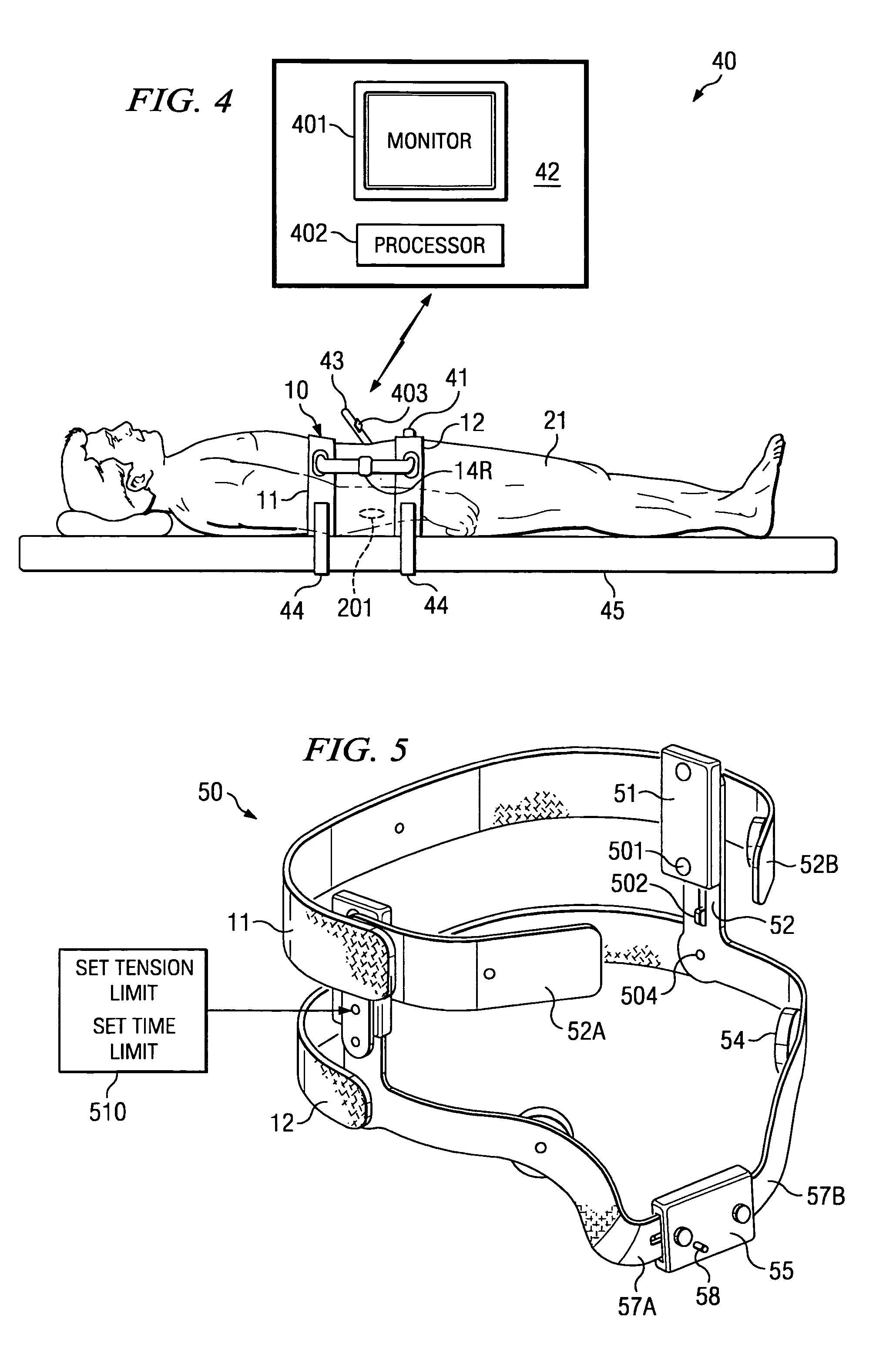 System and method for externally controlled surgical navigation