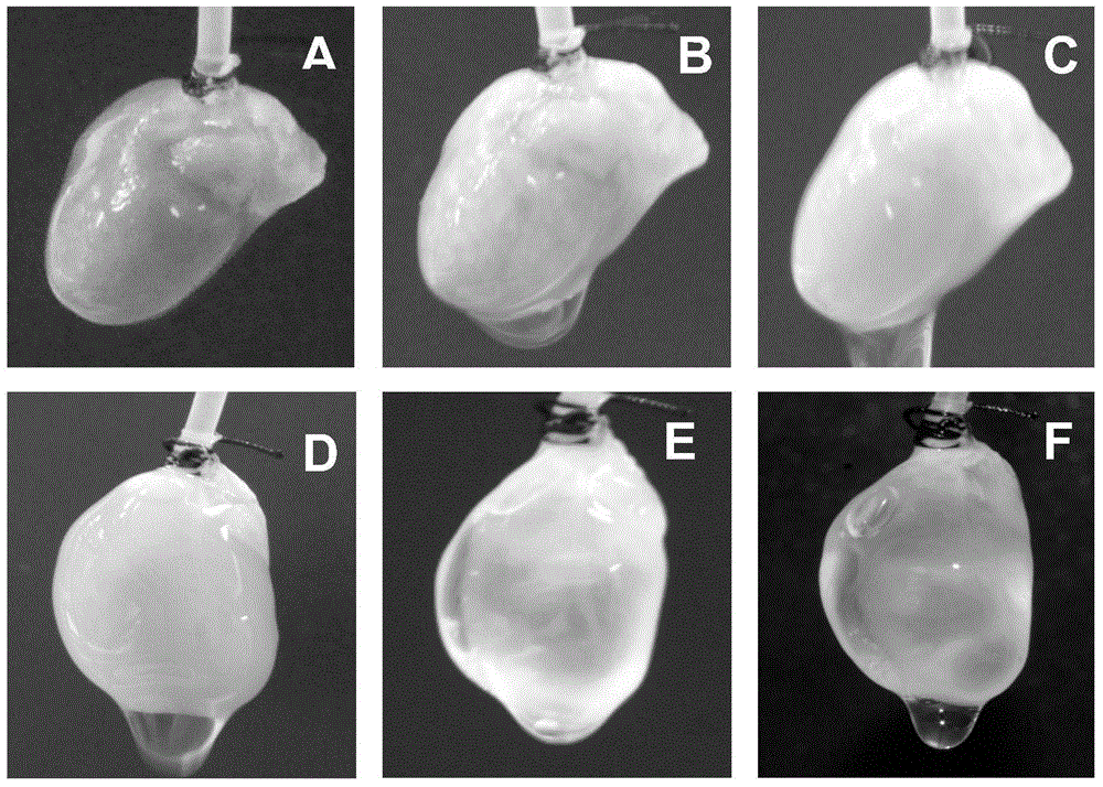 Human tissue-engineered cardiac muscle tissue