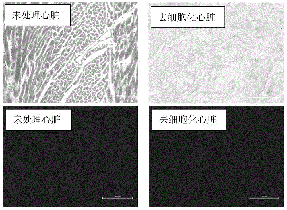 Human tissue-engineered cardiac muscle tissue