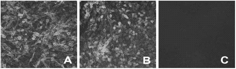 Building and application of hydrophobia DNA (deoxyribonucleic acid) vaccine