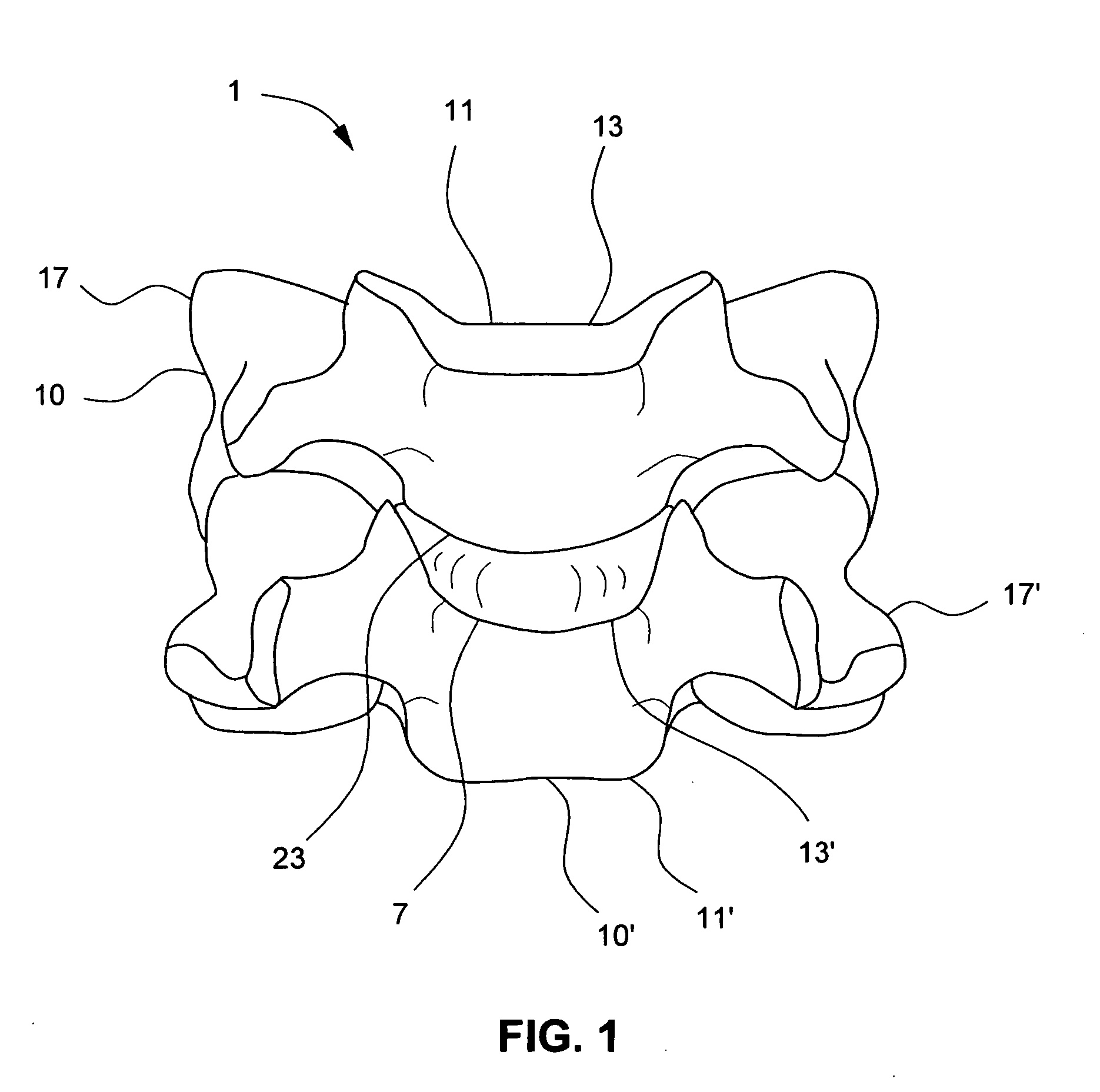 Artificial intervertebral disc