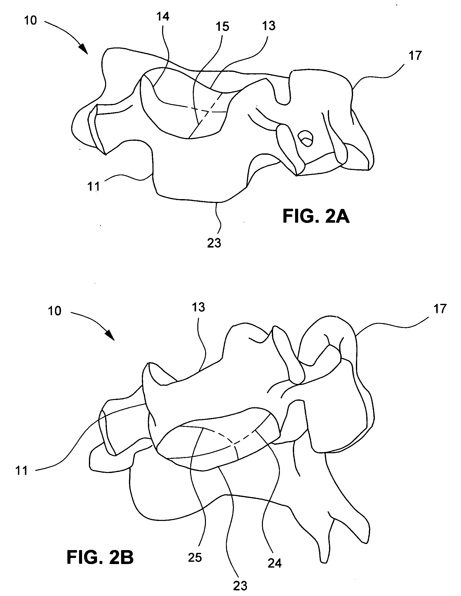 Artificial intervertebral disc