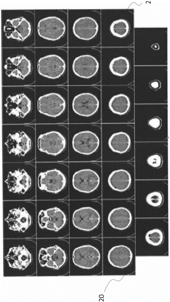 System and method for patient-specific radiotherapy treatment verification and quality assurance