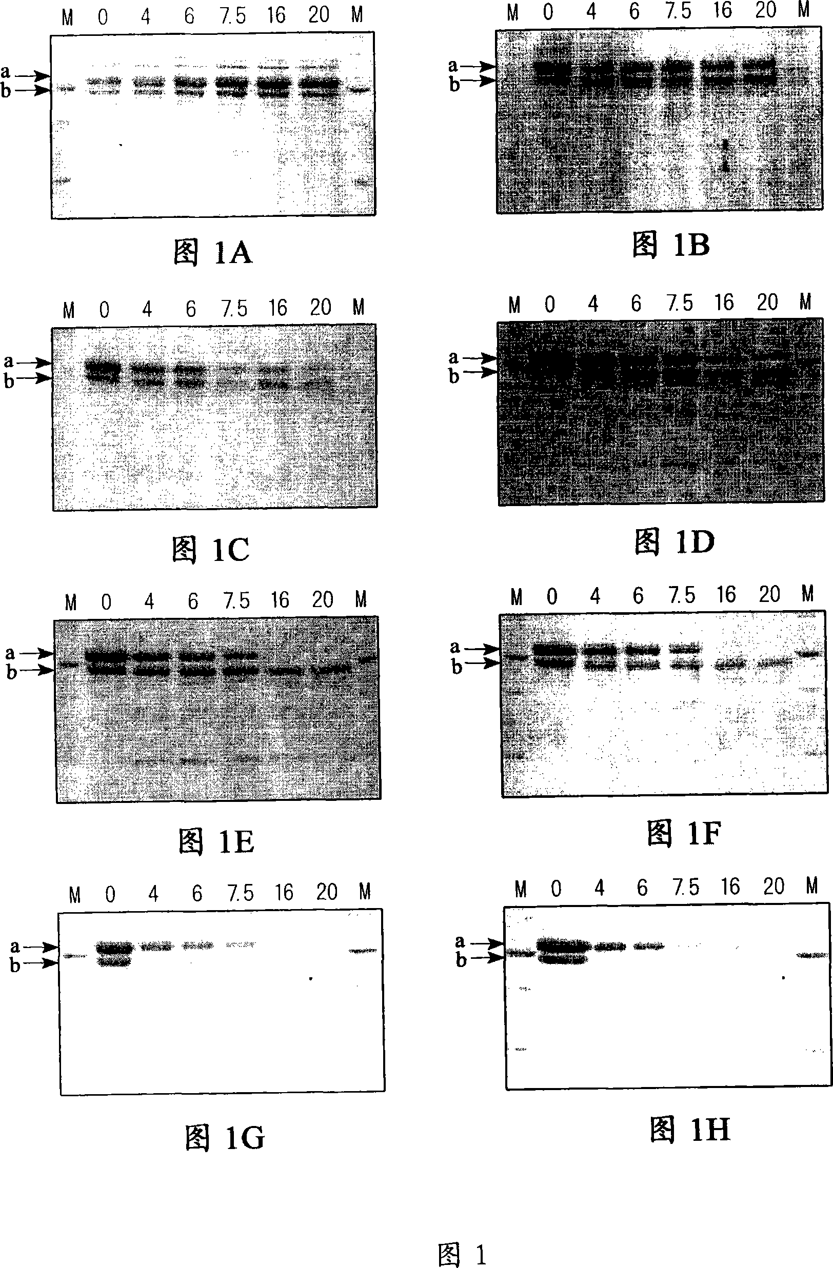 Queen gel clastic enzyme composition