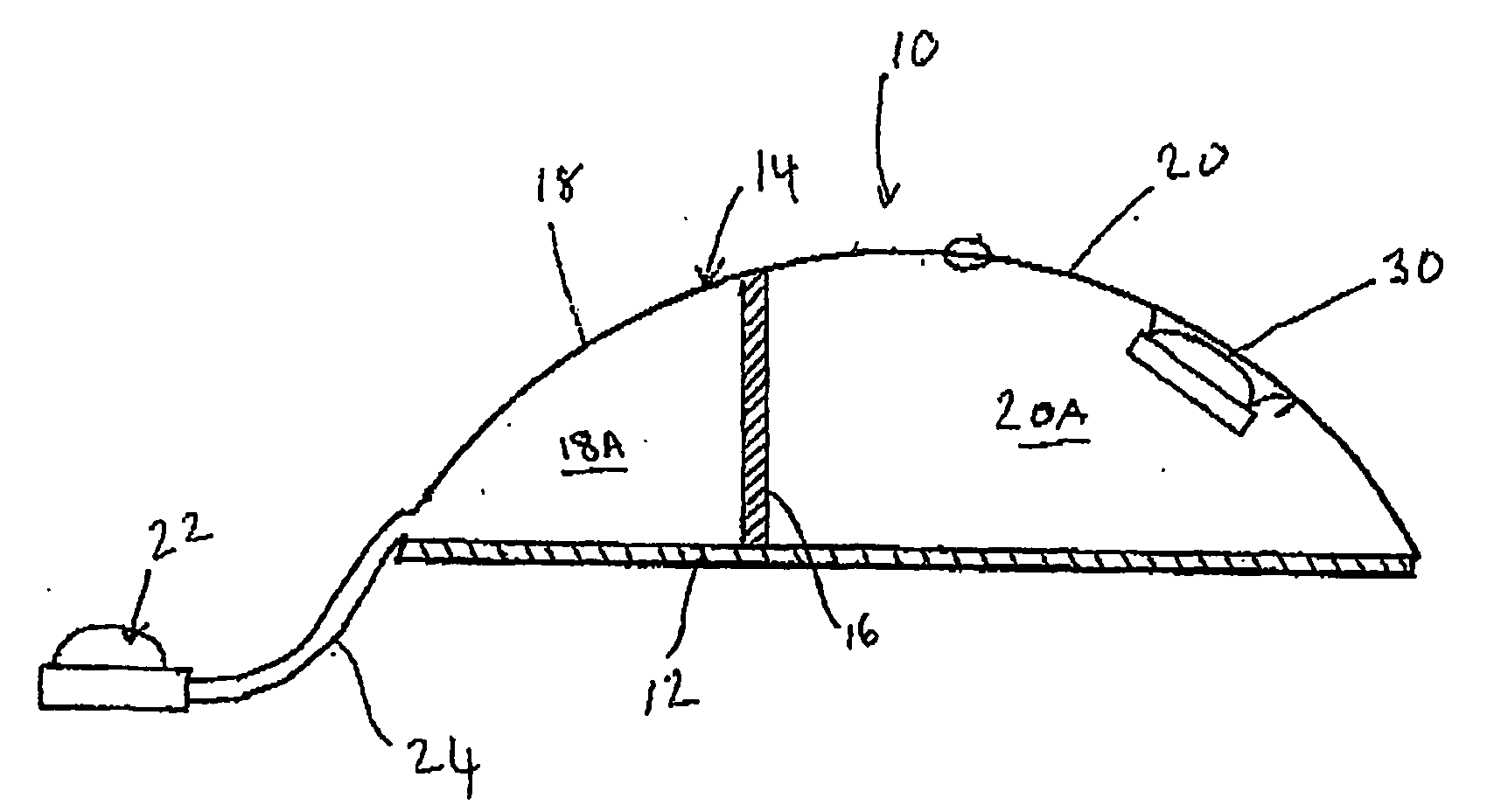 Differential Tissue Expander Implant