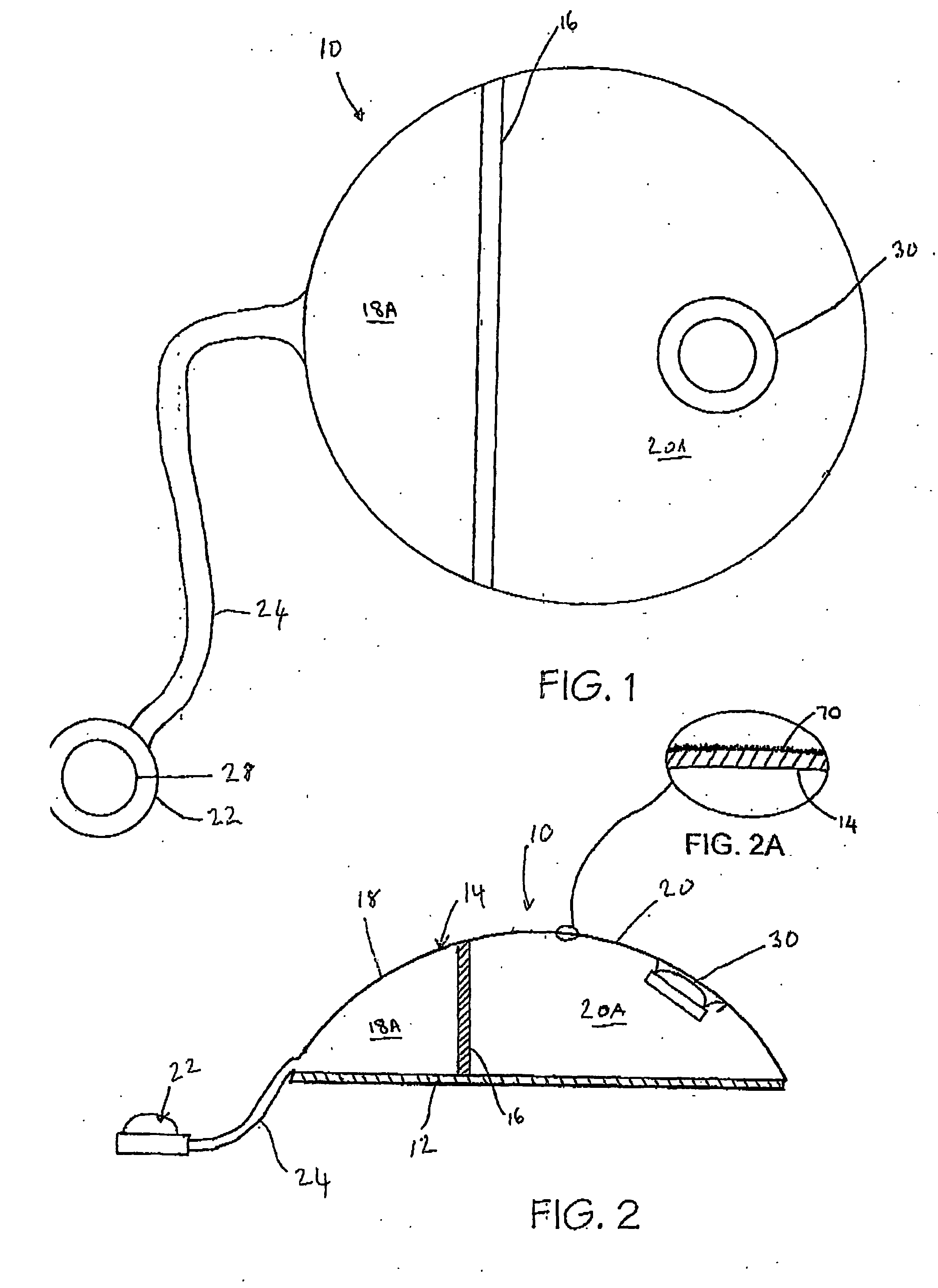 Differential Tissue Expander Implant