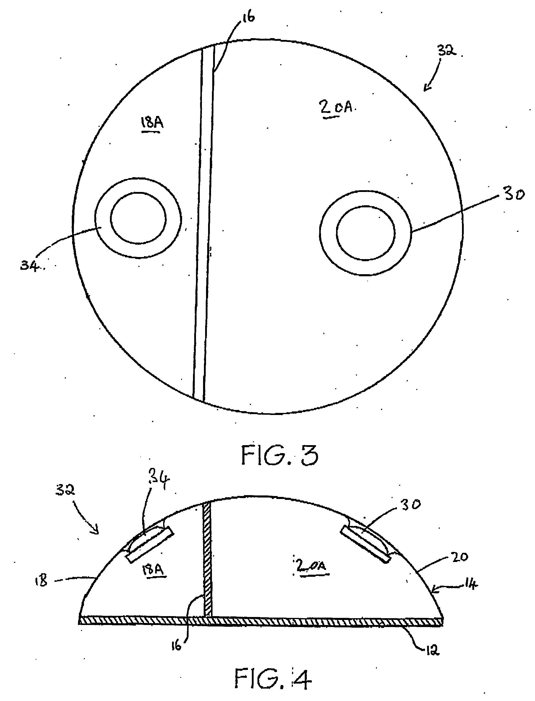 Differential Tissue Expander Implant