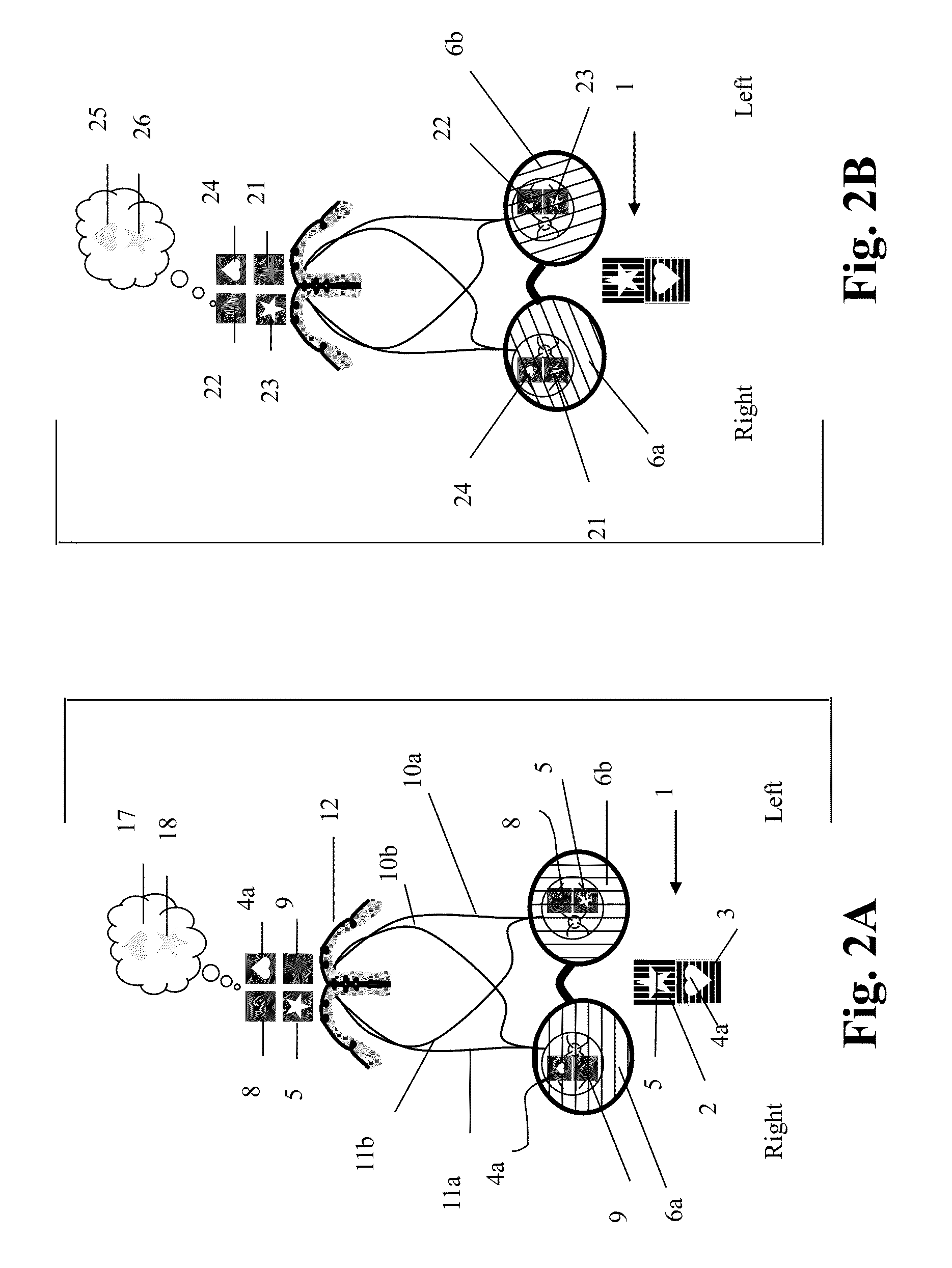 Amblyometer for balancing bridging rivalrous binocular vision