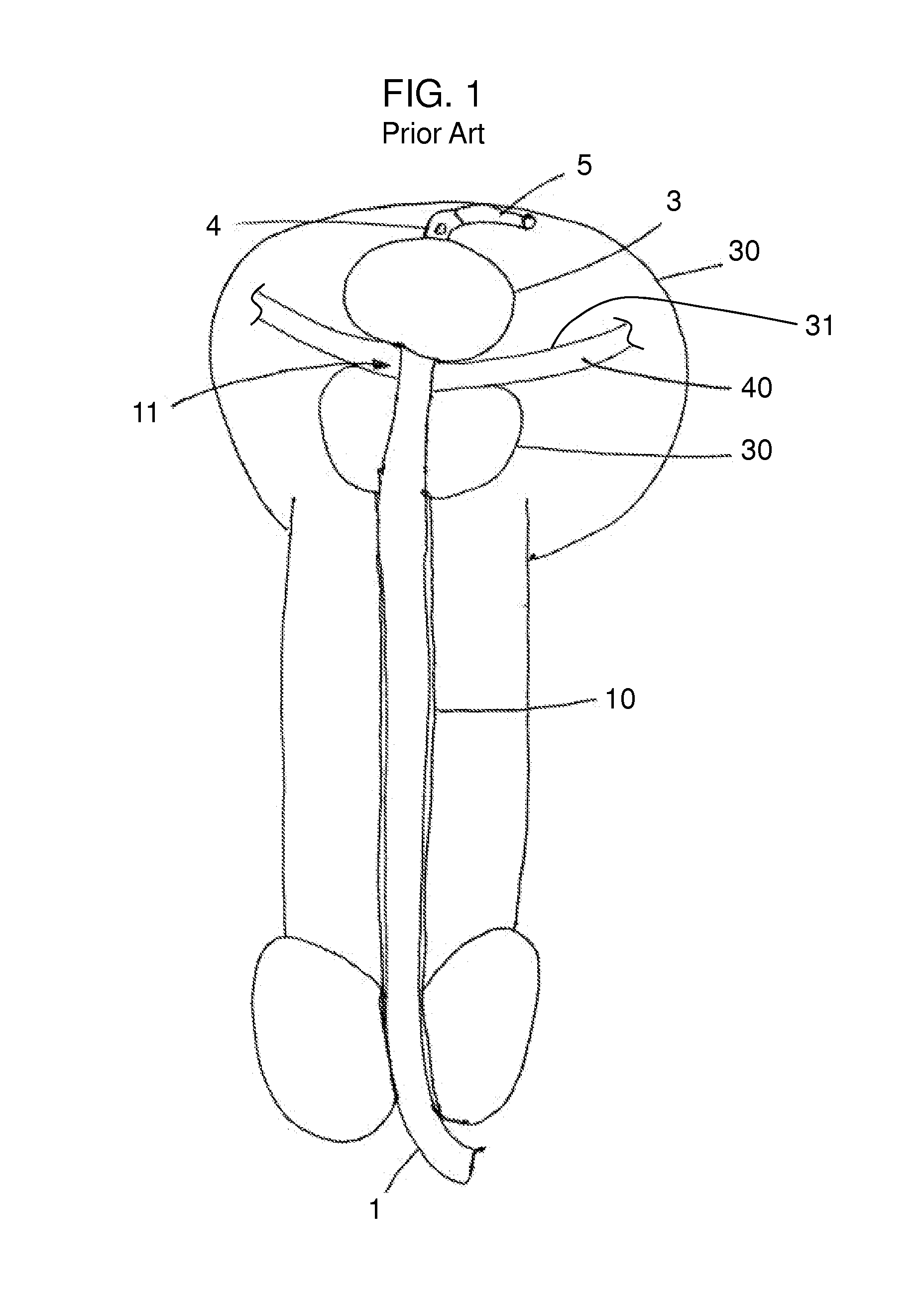 Stretch Valve Balloon Catheter and Methods for Producing and Using Same