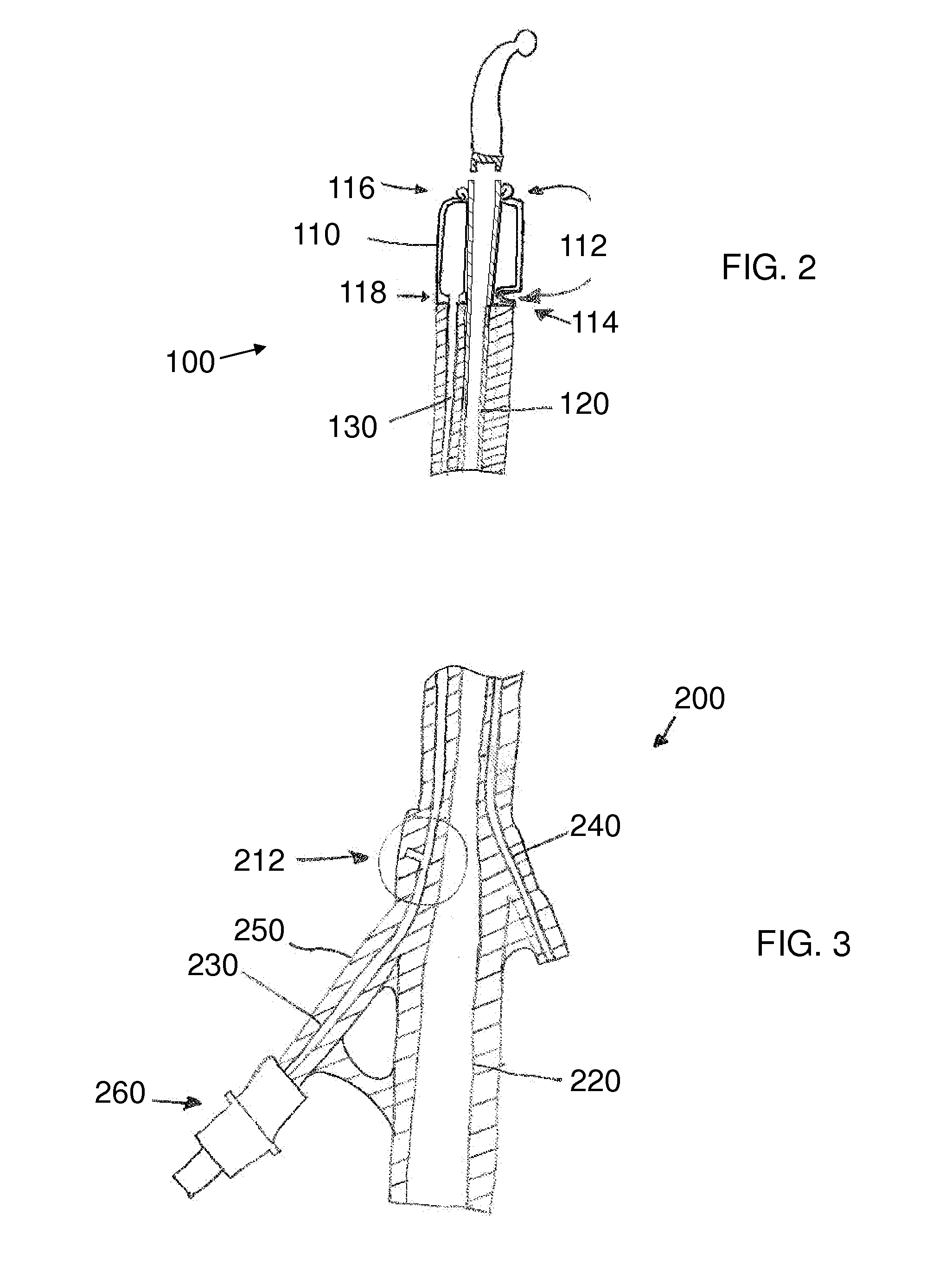 Stretch Valve Balloon Catheter and Methods for Producing and Using Same