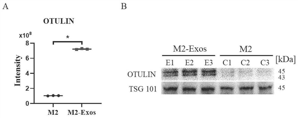 M2 type bone marrow macrophage exosome, application thereof and spinal cord injury treatment preparation